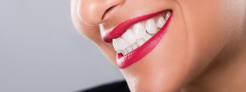 Dentiste Luxembourg - Esthetique du sourire