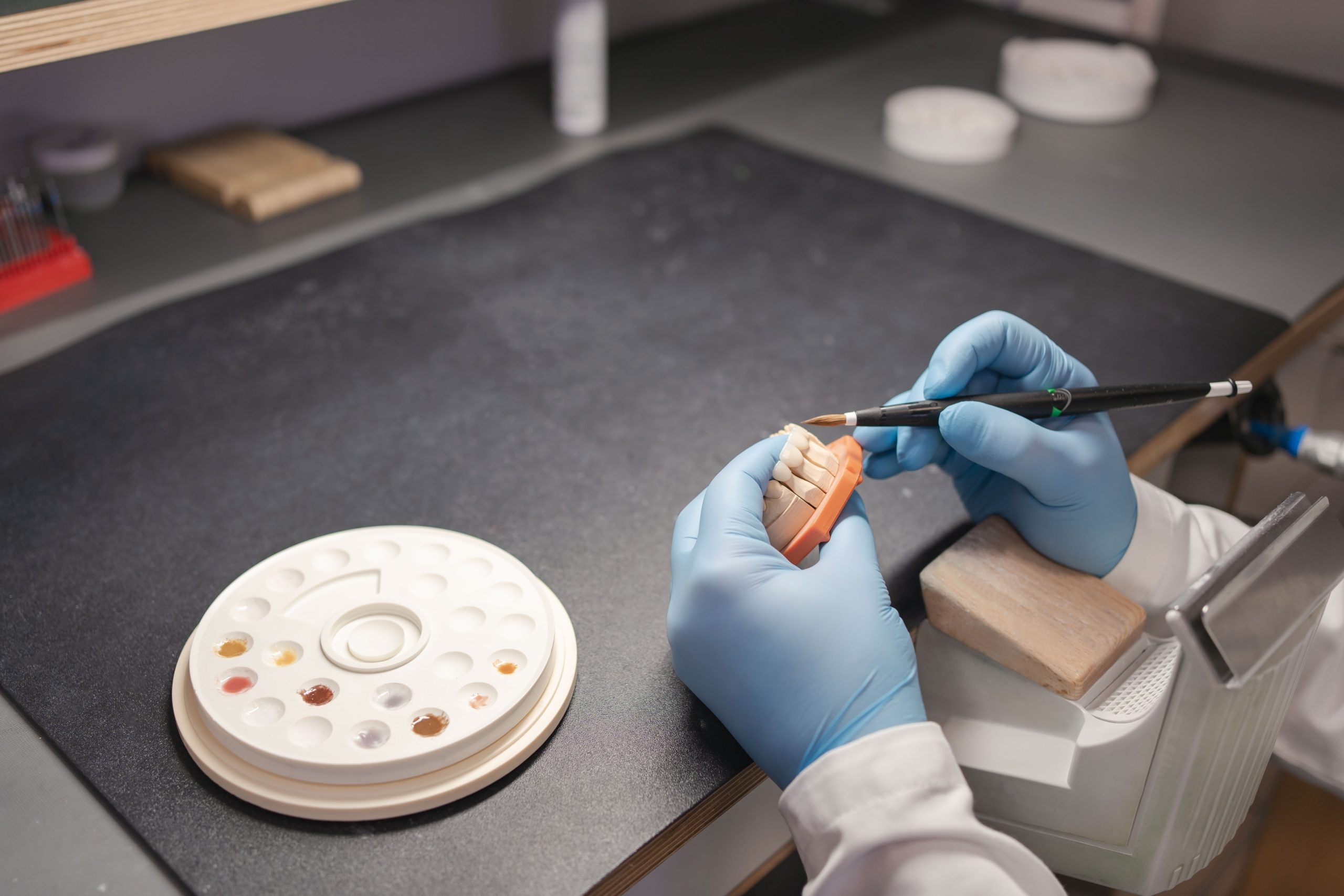 Mise en charge immédiate de l’implant : déroulement