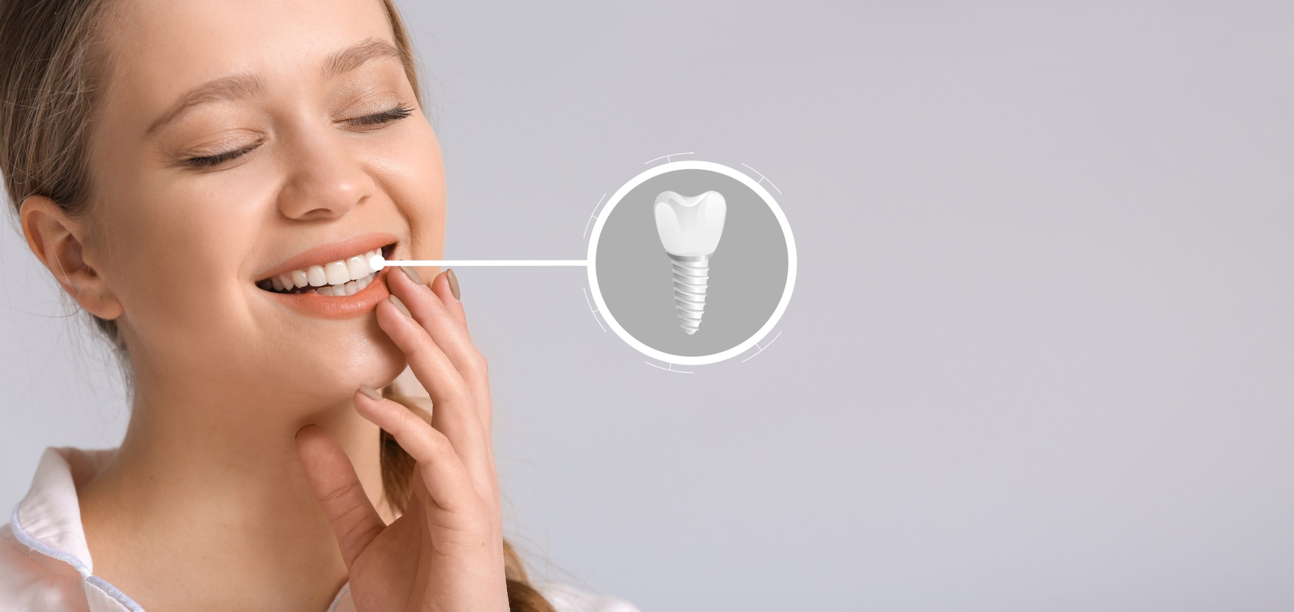 Implant dentaire titane ou zircone