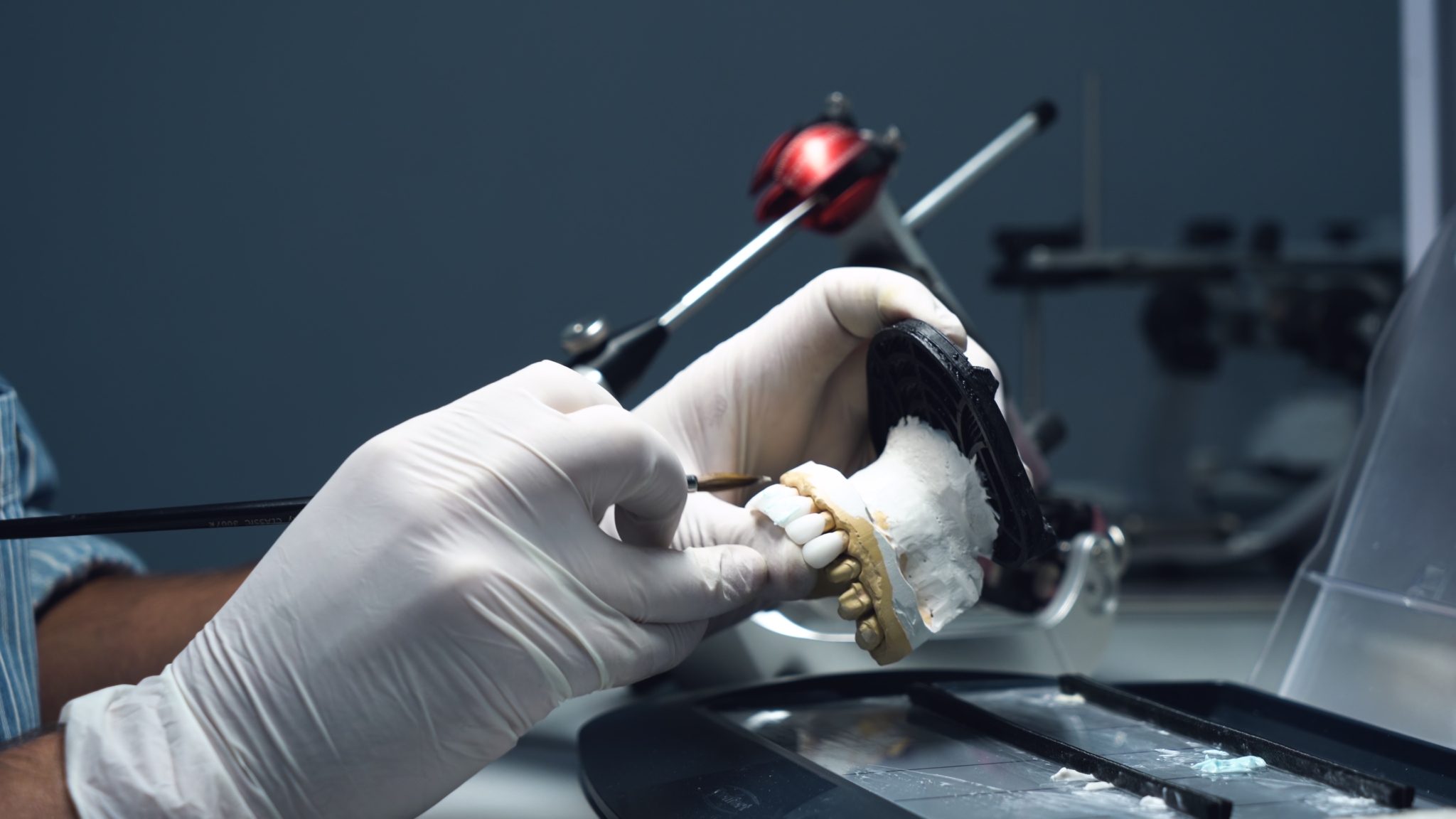 Implant dentaire titane ou zircone, quelles différences — free download
