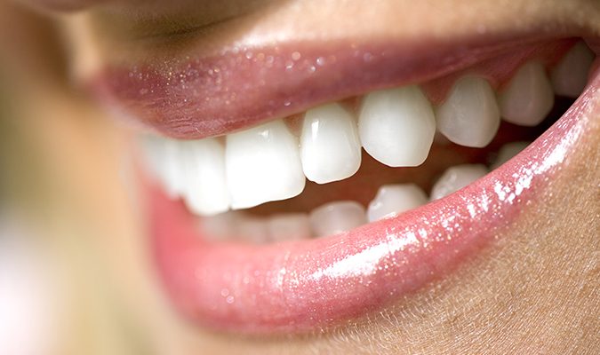 Eclaircissement dentaire Luxembourg - Dentiste Luxembourg