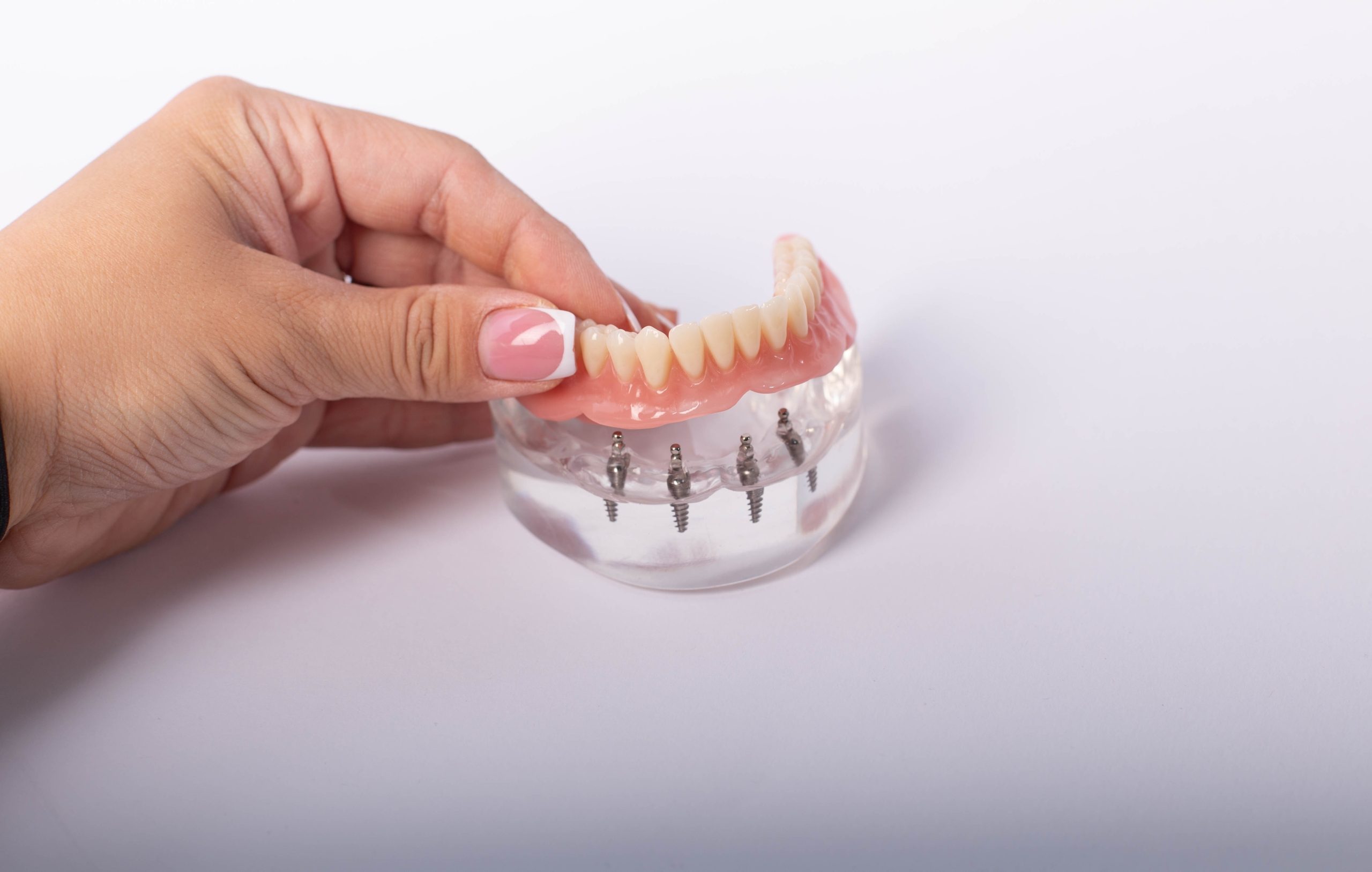 Les matériaux utilisés pour les prothèses dentaires fixes