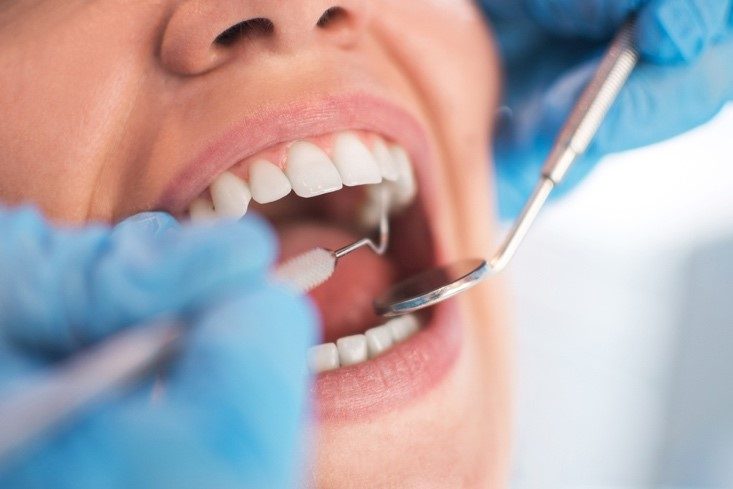 entretien implants chez le dentiste
