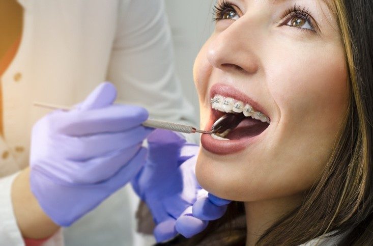 orthodontie implant dentaire
